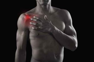 thoracic outlet syndrome Ogden Utah 