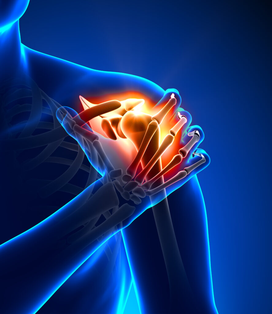 rotator cuff pain better sleep